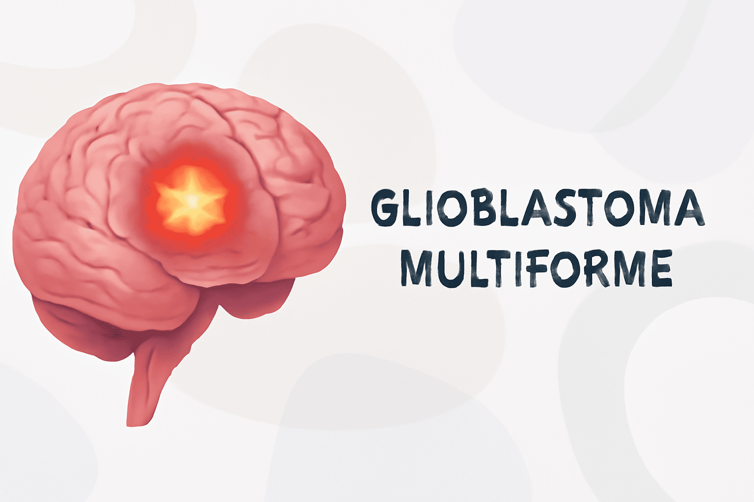 Glioblastoma Multiforme